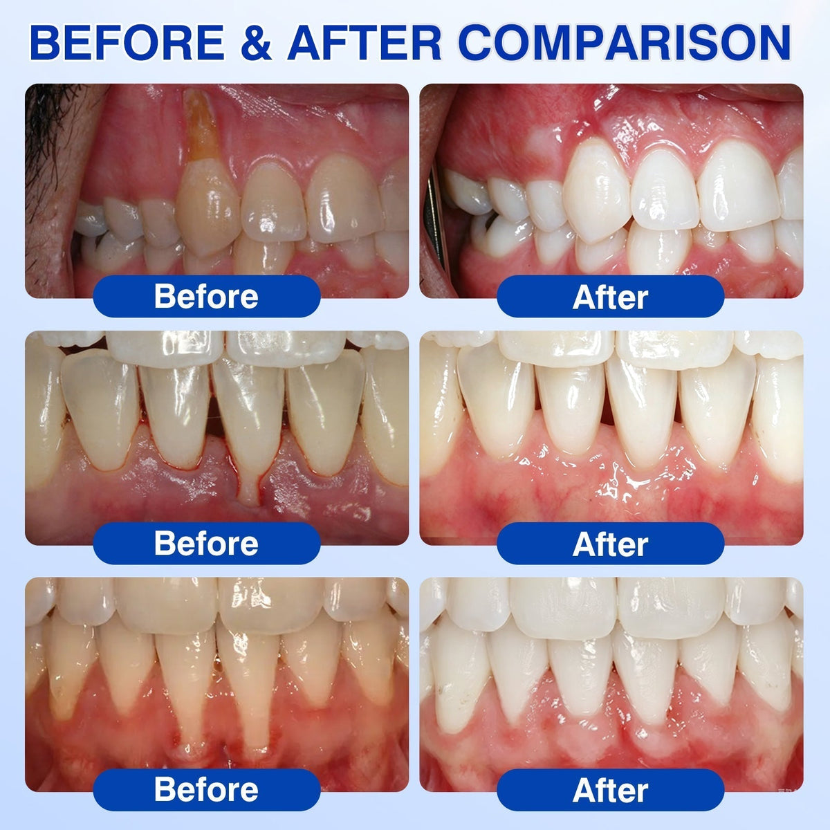 🇺🇸🏅🦷𝐎𝐟𝐟𝐢𝐜𝐢𝐚𝐥 𝐒𝐭𝐨𝐫𝐞 | 𝐃𝐫.𝐄𝐫𝐚® 𝐆𝐮𝐦𝐑𝐞𝐯𝐢𝐯𝐞 𝐏𝐞𝐫𝐢𝐨𝐝𝐨𝐧𝐭𝐚𝐥 𝐑𝐞𝐩𝐚𝐢𝐫 𝐆𝐞𝐥 — 𝐓𝐚𝐫𝐠𝐞𝐭𝐞𝐝 𝐆𝐮𝐦𝐥𝐢𝐧𝐞 𝐒𝐮𝐩𝐩𝐨𝐫𝐭 𝐟𝐨𝐫 𝐏𝐥𝐚𝐪𝐮𝐞, 𝐂𝐚𝐯𝐢𝐭𝐢𝐞𝐬, 𝐏𝐞𝐫𝐢𝐨𝐝𝐨𝐧𝐭𝐚𝐥 𝐂𝐨𝐧𝐜𝐞𝐫𝐧𝐬, 𝐁𝐚𝐝 𝐁𝐫𝐞𝐚𝐭𝐡 & 𝐖𝐞𝐚𝐤 𝐓𝐞𝐞𝐭𝐡 | 𝐏𝐫𝐞𝐜𝐢𝐬𝐢𝐨𝐧 𝐋𝐞𝐚𝐯𝐞-𝐎𝐧 𝐎𝐫𝐚𝐥 𝐂𝐚𝐫𝐞 𝐅𝐨𝐫𝐦𝐮𝐥𝐚