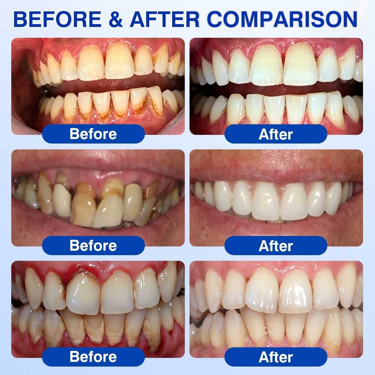 🇺🇸🏅🦷𝐎𝐟𝐟𝐢𝐜𝐢𝐚𝐥 𝐒𝐭𝐨𝐫𝐞 | 𝐃𝐫.𝐄𝐫𝐚® 𝐆𝐮𝐦𝐑𝐞𝐯𝐢𝐯𝐞 𝐏𝐞𝐫𝐢𝐨𝐝𝐨𝐧𝐭𝐚𝐥 𝐑𝐞𝐩𝐚𝐢𝐫 𝐆𝐞𝐥 — 𝐓𝐚𝐫𝐠𝐞𝐭𝐞𝐝 𝐆𝐮𝐦𝐥𝐢𝐧𝐞 𝐒𝐮𝐩𝐩𝐨𝐫𝐭 𝐟𝐨𝐫 𝐏𝐥𝐚𝐪𝐮𝐞, 𝐂𝐚𝐯𝐢𝐭𝐢𝐞𝐬, 𝐏𝐞𝐫𝐢𝐨𝐝𝐨𝐧𝐭𝐚𝐥 𝐂𝐨𝐧𝐜𝐞𝐫𝐧𝐬, 𝐁𝐚𝐝 𝐁𝐫𝐞𝐚𝐭𝐡 & 𝐖𝐞𝐚𝐤 𝐓𝐞𝐞𝐭𝐡 | 𝐏𝐫𝐞𝐜𝐢𝐬𝐢𝐨𝐧 𝐋𝐞𝐚𝐯𝐞-𝐎𝐧 𝐎𝐫𝐚𝐥 𝐂𝐚𝐫𝐞 𝐅𝐨𝐫𝐦𝐮𝐥𝐚