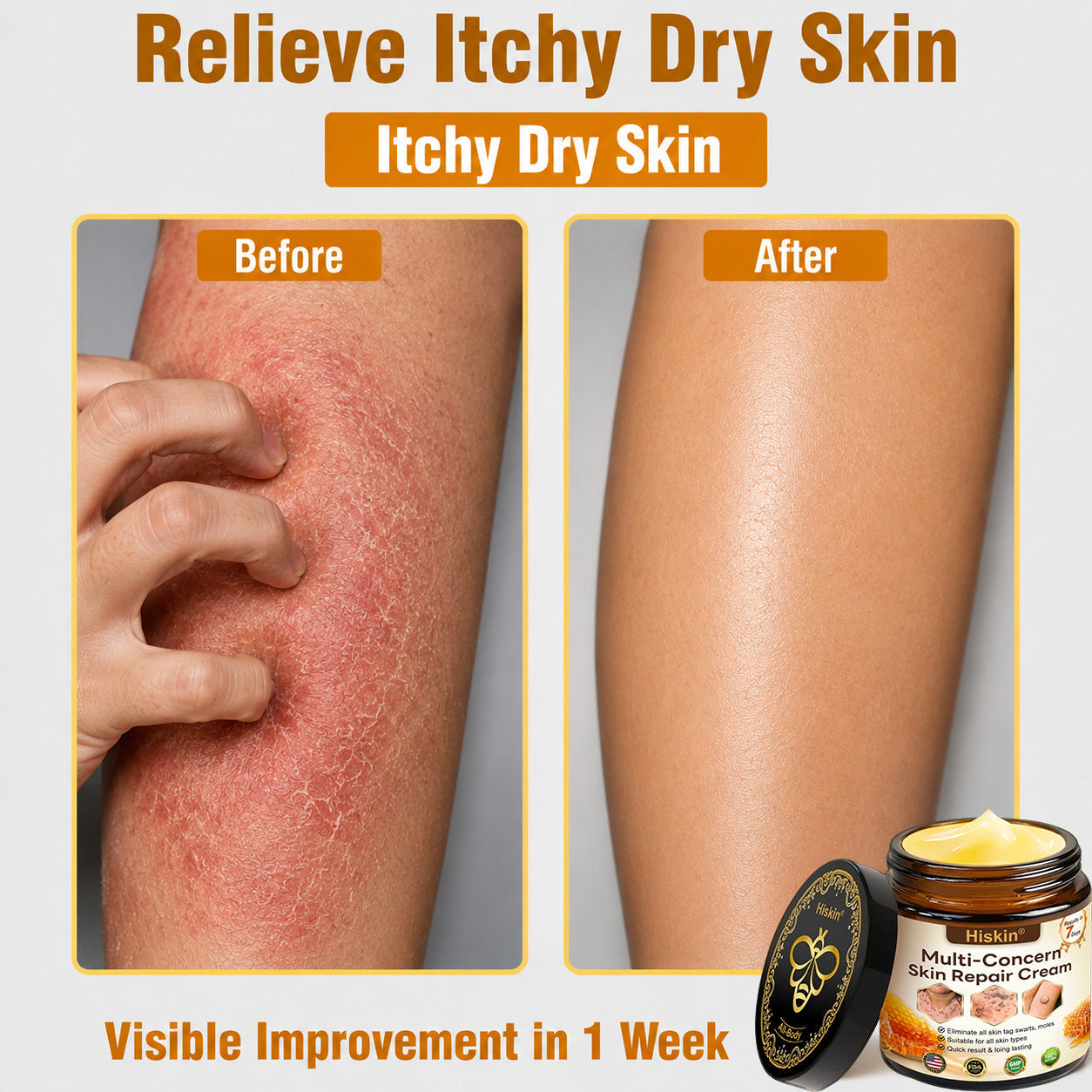 One last chance! Grab this lucky find at 90% OFF to erase warts permanently!🔥 180-day money back guarantee! Act fast! HISKIN®