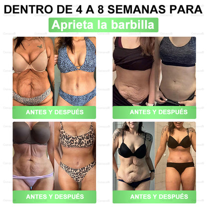 𝑶𝒇𝒇𝒊𝒄𝒊𝒂𝒍 𝑺𝒕𝒐𝒓𝒆 | 𝐃𝐑.𝐇𝐎𝐍𝐎𝐑® 𝗠𝗼𝗿𝗶𝗻𝗴𝗮 · 𝗕𝗲𝗿𝗯𝗲𝗿𝗶𝗻𝗲 × 𝗡𝗔𝗗+ 𝟏𝟎-𝐢𝐧-𝟏 𝐀𝐝𝐯𝐚𝐧𝐜𝐞𝐝 𝐍𝐚𝐧𝐨 𝐌𝐢𝐜𝐫𝐨𝐧𝐞𝐞𝐝𝐥𝐞 𝐏𝐚𝐭𝐜𝐡 (𝐉𝐮𝐬𝐭 𝐨𝐧𝐜𝐞 𝐚 𝐝𝐚𝐲, 𝐯𝐢𝐬𝐢𝐛𝐥𝐞 𝐜𝐡𝐚𝐧𝐠𝐞𝐬 𝐢𝐧 𝟕 𝐝𝐚𝐲𝐬）𝘽𝙚𝙧𝙗𝙚𝙧𝙞𝙣𝙚 + 𝙈𝙤𝙧𝙞𝙣𝙜𝙖 𝙁𝙤𝙧𝙢𝙪𝙡𝙖 ✅ 𝐅𝐨𝐫 𝐨𝐛𝐞𝐬𝐢𝐭𝐲, 𝗟𝗼𝗼𝘀𝗲 𝘀𝗸𝗶𝗻,𝐝𝐢𝐚𝐛𝐞𝐭𝐞𝐬, 𝐬𝐥𝐞𝐞𝐩 𝐚𝐩𝐧𝐞𝐚, 𝐣𝐨𝐢𝐧𝐭 𝐢𝐬𝐬𝐮𝐞𝐬, 𝐚𝐧𝐝 𝐦𝐨𝐫𝐞💯💯