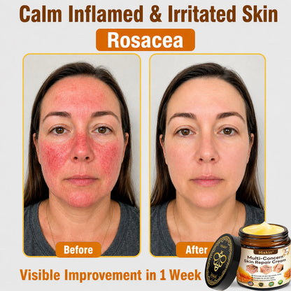 One last chance! Grab this lucky find at 90% OFF to erase warts permanently!🔥 180-day money back guarantee! Act fast! HISKIN®