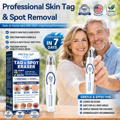 Only 7 Pack Left! Get an exclusive 80% discount on HISKIN® Rollerball Pen today! Say goodbye to embarrassing warts and skin tags in just 1 to 4 weeks. Don’t miss out—Flash Renewal Offer! Plus, enjoy a 180-day money-back guarantee. Act fast!