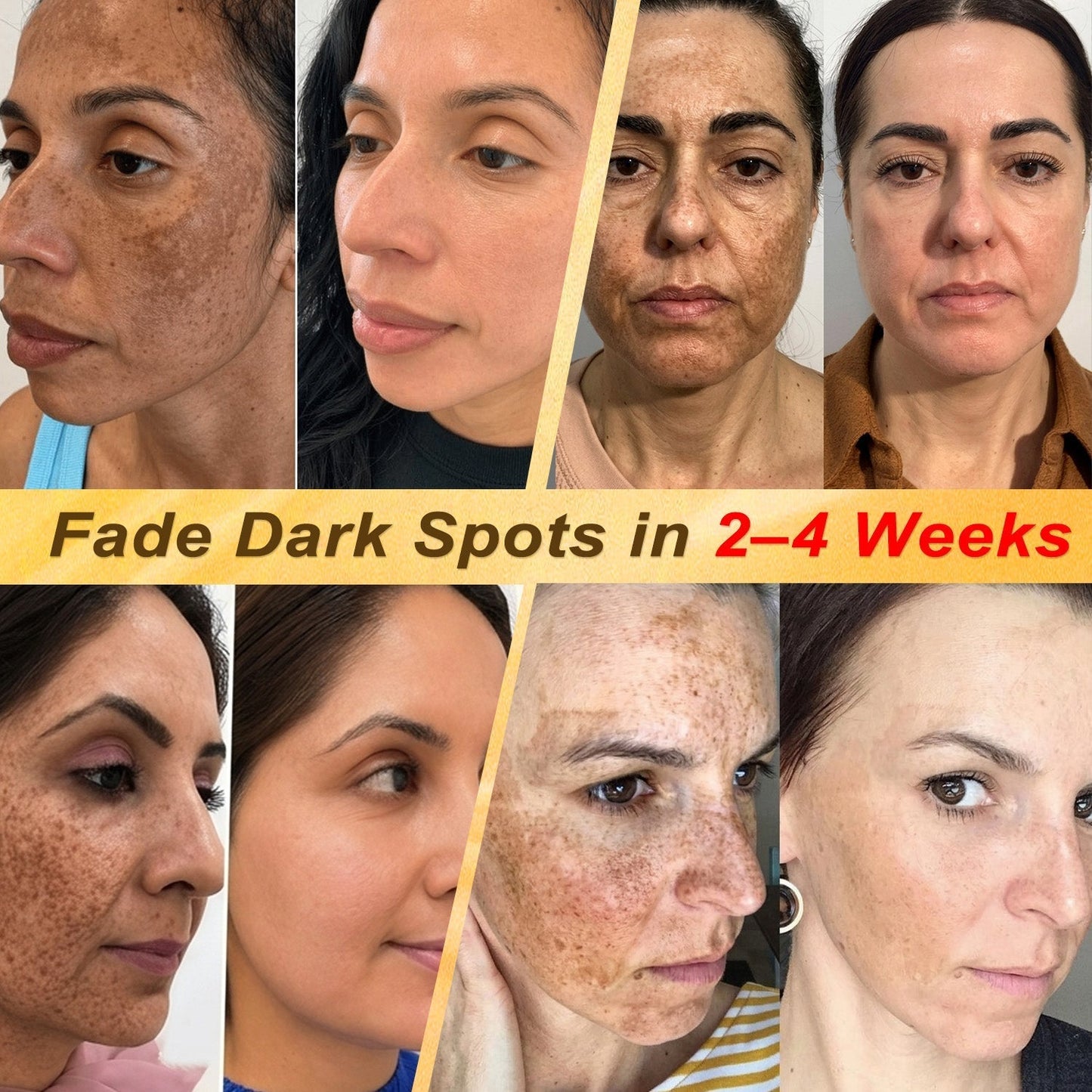 One last chance! Grab this lucky find at 90% OFF to erase warts permanently!🔥 180-day money back guarantee! Act fast! HISKIN®