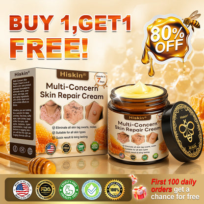 One last chance! Grab this lucky find at 90% OFF to erase warts permanently!🔥 180-day money back guarantee! Act fast! HISKIN®