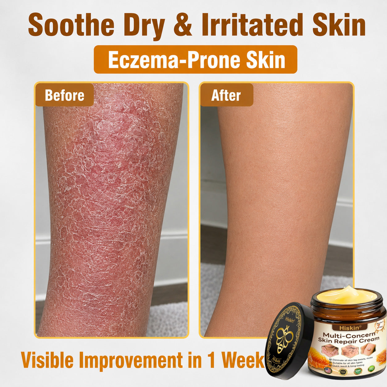 One last chance! Grab this lucky find at 90% OFF to erase warts permanently!🔥 180-day money back guarantee! Act fast! HISKIN®