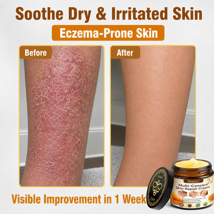 One last chance! Grab this lucky find at 90% OFF to erase warts permanently!🔥 180-day money back guarantee! Act fast! HISKIN®