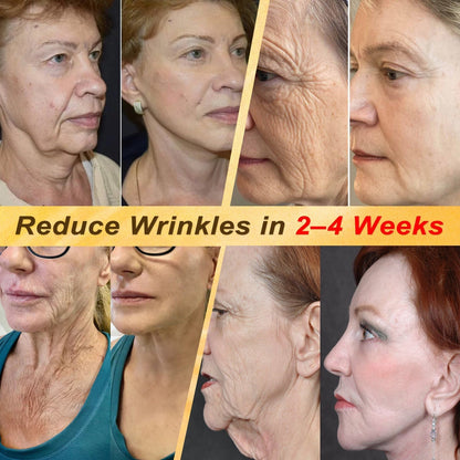 One last chance! Grab this lucky find at 90% OFF to erase warts permanently!🔥 180-day money back guarantee! Act fast! HISKIN®