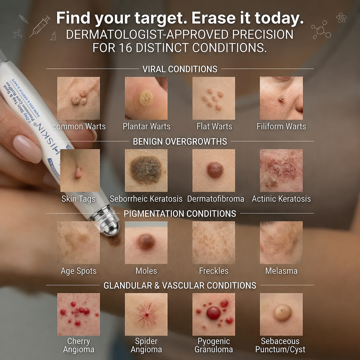 Only 7 Pack Left! Get an exclusive 80% discount on HISKIN® Rollerball Pen today! Say goodbye to embarrassing warts and skin tags in just 1 to 4 weeks. Don’t miss out—Flash Renewal Offer! Plus, enjoy a 180-day money-back guarantee. Act fast!