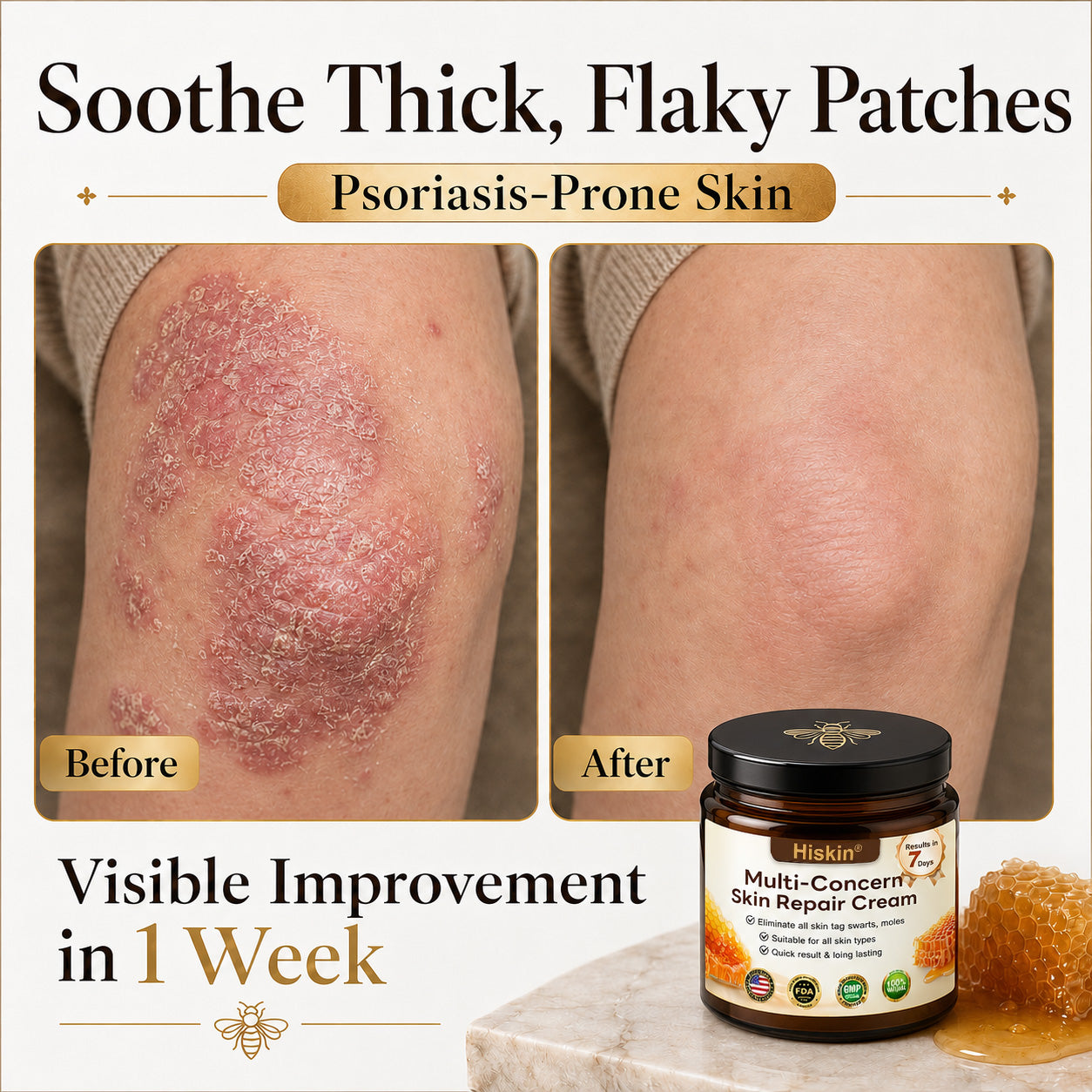 One last chance! Grab this lucky find at 90% OFF to erase warts permanently!🔥 180-day money back guarantee! Act fast! HISKIN®
