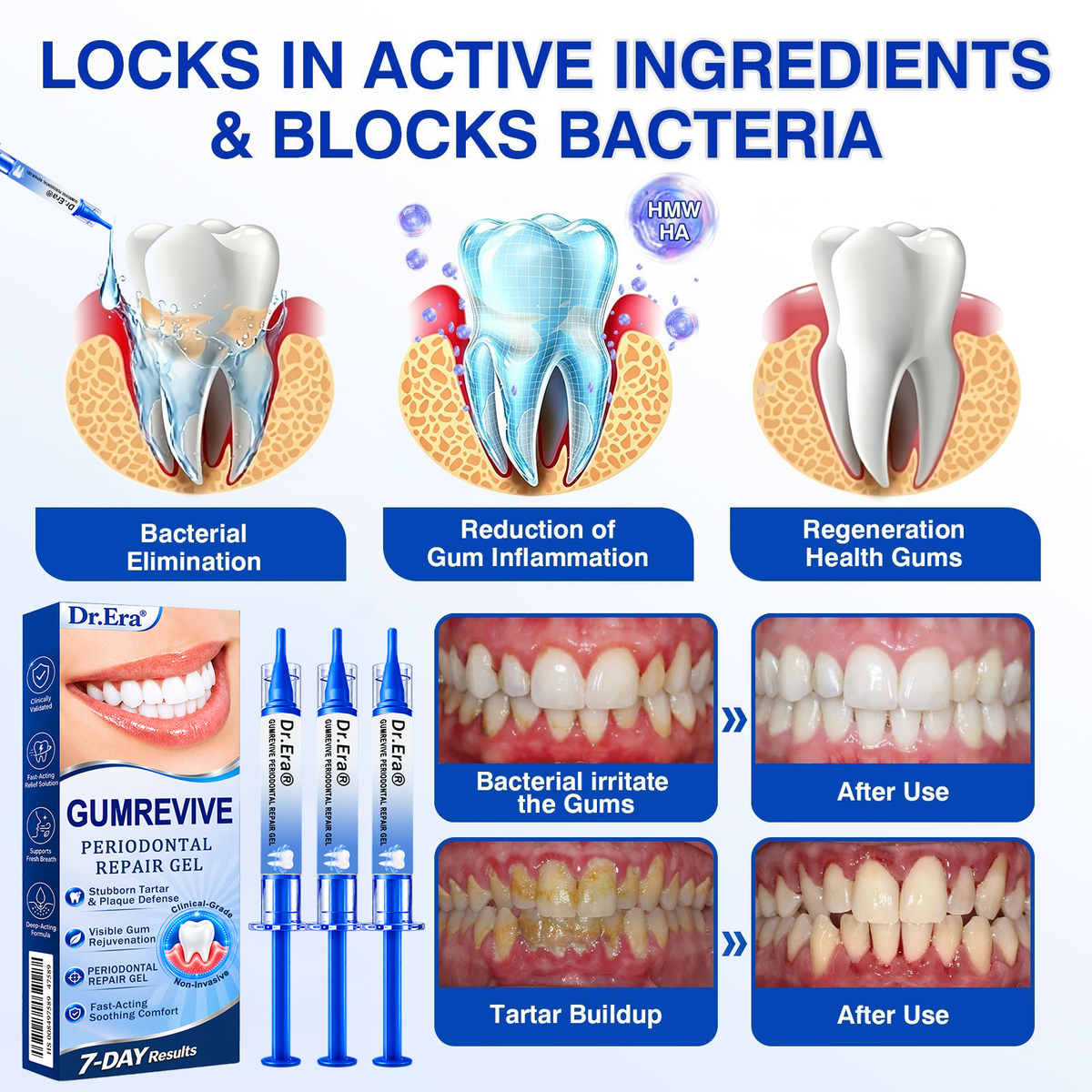 🇺🇸🏅🦷𝐎𝐟𝐟𝐢𝐜𝐢𝐚𝐥 𝐒𝐭𝐨𝐫𝐞 | 𝐃𝐫.𝐄𝐫𝐚® 𝐆𝐮𝐦𝐑𝐞𝐯𝐢𝐯𝐞 𝐏𝐞𝐫𝐢𝐨𝐝𝐨𝐧𝐭𝐚𝐥 𝐑𝐞𝐩𝐚𝐢𝐫 𝐆𝐞𝐥 — 𝐓𝐚𝐫𝐠𝐞𝐭𝐞𝐝 𝐆𝐮𝐦𝐥𝐢𝐧𝐞 𝐒𝐮𝐩𝐩𝐨𝐫𝐭 𝐟𝐨𝐫 𝐏𝐥𝐚𝐪𝐮𝐞, 𝐂𝐚𝐯𝐢𝐭𝐢𝐞𝐬, 𝐏𝐞𝐫𝐢𝐨𝐝𝐨𝐧𝐭𝐚𝐥 𝐂𝐨𝐧𝐜𝐞𝐫𝐧𝐬, 𝐁𝐚𝐝 𝐁𝐫𝐞𝐚𝐭𝐡 & 𝐖𝐞𝐚𝐤 𝐓𝐞𝐞𝐭𝐡 | 𝐏𝐫𝐞𝐜𝐢𝐬𝐢𝐨𝐧 𝐋𝐞𝐚𝐯𝐞-𝐎𝐧 𝐎𝐫𝐚𝐥 𝐂𝐚𝐫𝐞 𝐅𝐨𝐫𝐦𝐮𝐥𝐚