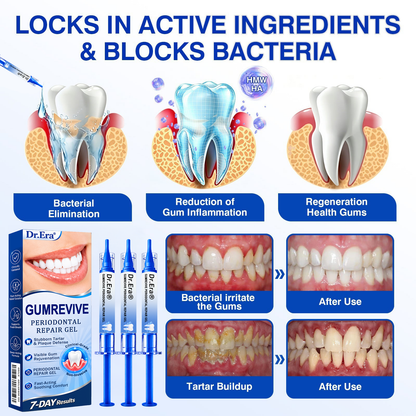 🇺🇸🏅🦷𝐎𝐟𝐟𝐢𝐜𝐢𝐚𝐥 𝐒𝐭𝐨𝐫𝐞 | 𝐃𝐫.𝐄𝐫𝐚® 𝐆𝐮𝐦𝐑𝐞𝐯𝐢𝐯𝐞 𝐏𝐞𝐫𝐢𝐨𝐝𝐨𝐧𝐭𝐚𝐥 𝐑𝐞𝐩𝐚𝐢𝐫 𝐆𝐞𝐥 — 𝐓𝐚𝐫𝐠𝐞𝐭𝐞𝐝 𝐆𝐮𝐦𝐥𝐢𝐧𝐞 𝐒𝐮𝐩𝐩𝐨𝐫𝐭 𝐟𝐨𝐫 𝐏𝐥𝐚𝐪𝐮𝐞, 𝐂𝐚𝐯𝐢𝐭𝐢𝐞𝐬, 𝐏𝐞𝐫𝐢𝐨𝐝𝐨𝐧𝐭𝐚𝐥 𝐂𝐨𝐧𝐜𝐞𝐫𝐧𝐬, 𝐁𝐚𝐝 𝐁𝐫𝐞𝐚𝐭𝐡 & 𝐖𝐞𝐚𝐤 𝐓𝐞𝐞𝐭𝐡 | 𝐏𝐫𝐞𝐜𝐢𝐬𝐢𝐨𝐧 𝐋𝐞𝐚𝐯𝐞-𝐎𝐧 𝐎𝐫𝐚𝐥 𝐂𝐚𝐫𝐞 𝐅𝐨𝐫𝐦𝐮𝐥𝐚