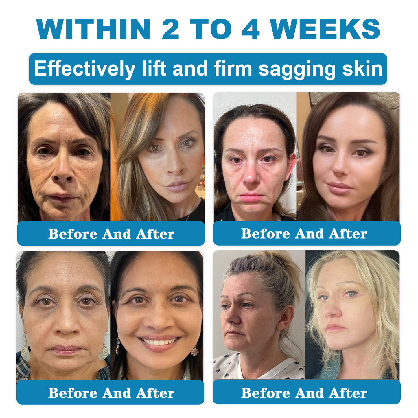 𝑶𝒏𝒍𝒚 4 Bottle! 𝑮𝒓𝒂𝒃 𝒂𝒏 𝒆𝒙𝒄𝒍𝒖𝒔𝒊𝒗𝒆 80% 𝒅𝒊𝒔𝒄𝒐𝒖𝒏𝒕 𝒏𝒐𝒘! 𝑲𝒆𝒆𝒑 𝒚𝒐𝒖𝒓 𝒔𝒌𝒊𝒏 𝒚𝒐𝒖𝒕𝒉𝒇𝒖𝒍 𝒂𝒏𝒅 𝒈𝒍𝒐𝒘𝒊𝒏𝒈 𝒊𝒏 𝒋𝒖𝒔𝒕 1 𝒕𝒐 4 𝒘𝒆𝒆𝒌𝒔. 𝑫𝒐𝒏’𝒕 𝒎𝒊𝒔𝒔 𝒚𝒐𝒖𝒓 𝒄𝒉𝒂𝒏𝒄𝒆—𝒕𝒉𝒊𝒔 𝒐𝒇𝒇𝒆𝒓 𝒘𝒐𝒏’𝒕 𝒄𝒐𝒎𝒆 𝒂𝒓𝒐𝒖𝒏𝒅 𝒂𝒈𝒂𝒊𝒏 𝒖𝒏𝒕𝒊𝒍 𝒏𝒆𝒙𝒕 𝒚𝒆𝒂𝒓. 180-𝒅𝒂𝒚 𝒎𝒐𝒏𝒆𝒚 𝒃𝒂𝒄𝒌 𝒈𝒖𝒂𝒓𝒂𝒏𝒕𝒆𝒆! HISKIN®