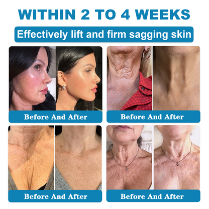 𝑶𝒏𝒍𝒚 4 Bottle! 𝑮𝒓𝒂𝒃 𝒂𝒏 𝒆𝒙𝒄𝒍𝒖𝒔𝒊𝒗𝒆 80% 𝒅𝒊𝒔𝒄𝒐𝒖𝒏𝒕 𝒏𝒐𝒘! 𝑲𝒆𝒆𝒑 𝒚𝒐𝒖𝒓 𝒔𝒌𝒊𝒏 𝒚𝒐𝒖𝒕𝒉𝒇𝒖𝒍 𝒂𝒏𝒅 𝒈𝒍𝒐𝒘𝒊𝒏𝒈 𝒊𝒏 𝒋𝒖𝒔𝒕 1 𝒕𝒐 4 𝒘𝒆𝒆𝒌𝒔. 𝑫𝒐𝒏’𝒕 𝒎𝒊𝒔𝒔 𝒚𝒐𝒖𝒓 𝒄𝒉𝒂𝒏𝒄𝒆—𝒕𝒉𝒊𝒔 𝒐𝒇𝒇𝒆𝒓 𝒘𝒐𝒏’𝒕 𝒄𝒐𝒎𝒆 𝒂𝒓𝒐𝒖𝒏𝒅 𝒂𝒈𝒂𝒊𝒏 𝒖𝒏𝒕𝒊𝒍 𝒏𝒆𝒙𝒕 𝒚𝒆𝒂𝒓. 180-𝒅𝒂𝒚 𝒎𝒐𝒏𝒆𝒚 𝒃𝒂𝒄𝒌 𝒈𝒖𝒂𝒓𝒂𝒏𝒕𝒆𝒆! HISKIN®