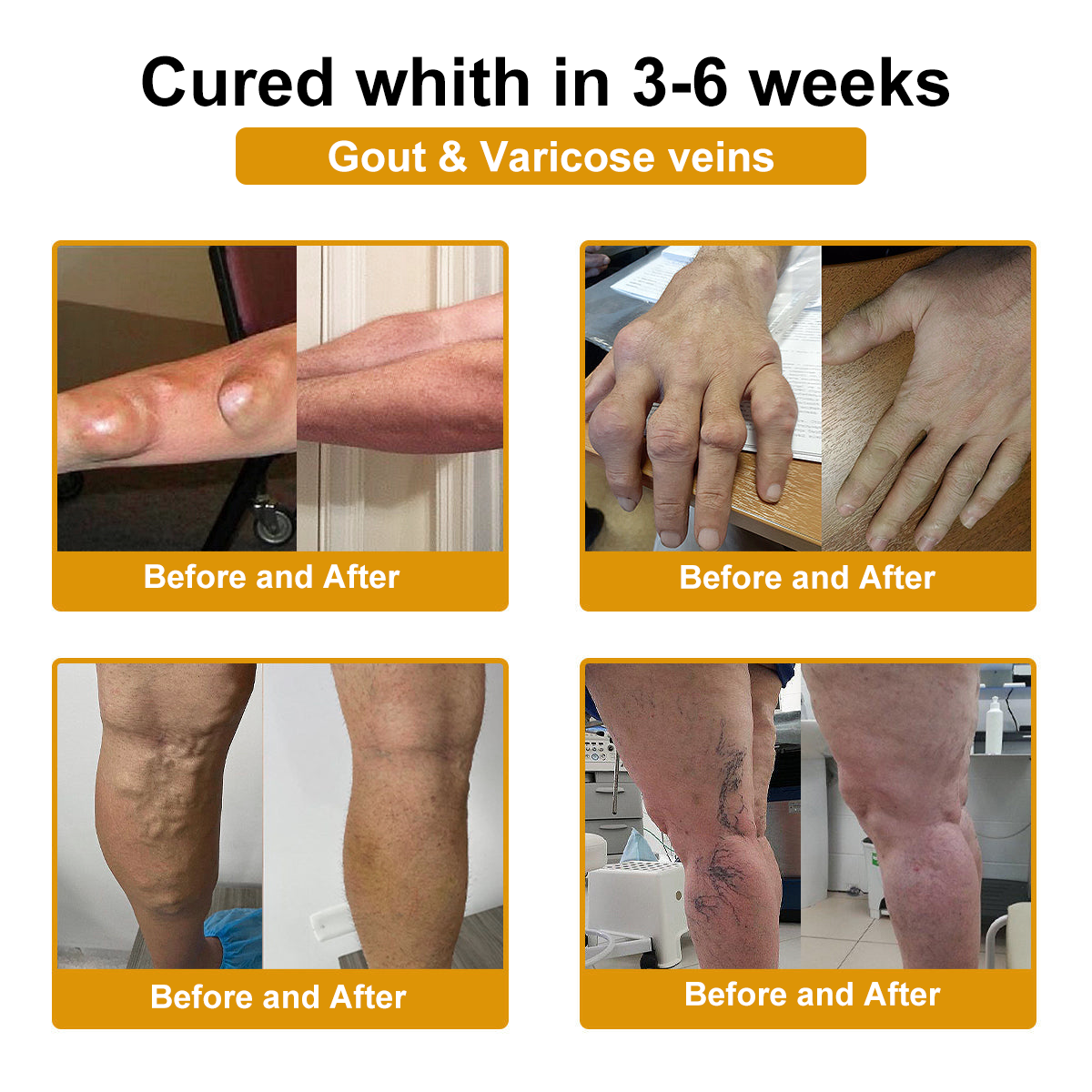 DR.HONOR® All-In-One Joint & Bone Recovery Cream 🎉🎉 Relieve arthritis-related pain, inflammation, swelling, stiffness, and muscle tension in just 7 days.