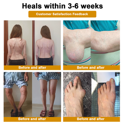 DR.HONOR® All-In-One Joint & Bone Recovery Cream 🎉🎉 Relieve arthritis-related pain, inflammation, swelling, stiffness, and muscle tension in just 7 days.