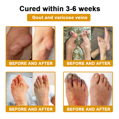 DR.HONOR® All-In-One Joint & Bone Recovery Cream 🎉🎉 Relieve arthritis-related pain, inflammation, swelling, stiffness, and muscle tension in just 7 days.