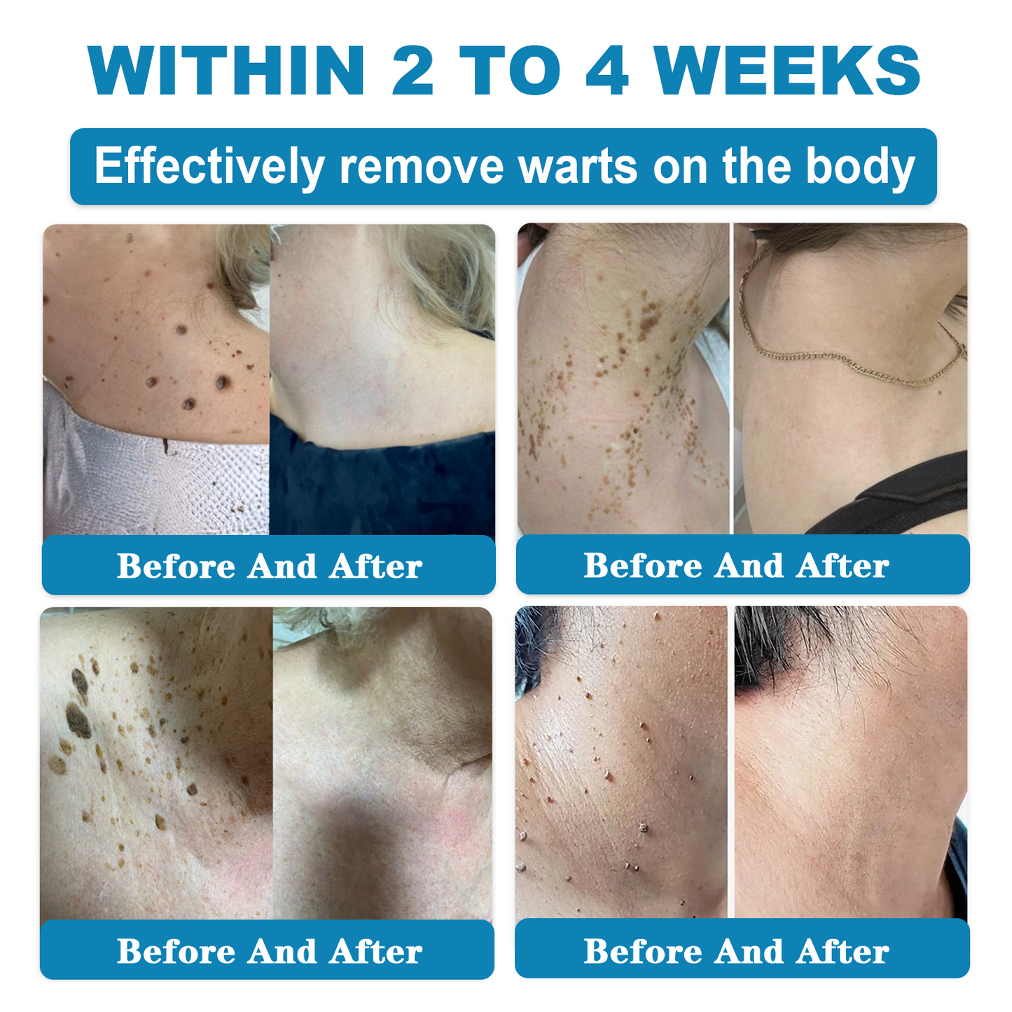 𝑶𝒏𝒍𝒚 4 Bottle! 𝑮𝒓𝒂𝒃 𝒂𝒏 𝒆𝒙𝒄𝒍𝒖𝒔𝒊𝒗𝒆 80% 𝒅𝒊𝒔𝒄𝒐𝒖𝒏𝒕 𝒏𝒐𝒘! 𝑲𝒆𝒆𝒑 𝒚𝒐𝒖𝒓 𝒔𝒌𝒊𝒏 𝒚𝒐𝒖𝒕𝒉𝒇𝒖𝒍 𝒂𝒏𝒅 𝒈𝒍𝒐𝒘𝒊𝒏𝒈 𝒊𝒏 𝒋𝒖𝒔𝒕 1 𝒕𝒐 4 𝒘𝒆𝒆𝒌𝒔. 𝑫𝒐𝒏’𝒕 𝒎𝒊𝒔𝒔 𝒚𝒐𝒖𝒓 𝒄𝒉𝒂𝒏𝒄𝒆—𝒕𝒉𝒊𝒔 𝒐𝒇𝒇𝒆𝒓 𝒘𝒐𝒏’𝒕 𝒄𝒐𝒎𝒆 𝒂𝒓𝒐𝒖𝒏𝒅 𝒂𝒈𝒂𝒊𝒏 𝒖𝒏𝒕𝒊𝒍 𝒏𝒆𝒙𝒕 𝒚𝒆𝒂𝒓. 180-𝒅𝒂𝒚 𝒎𝒐𝒏𝒆𝒚 𝒃𝒂𝒄𝒌 𝒈𝒖𝒂𝒓𝒂𝒏𝒕𝒆𝒆! HISKIN®
