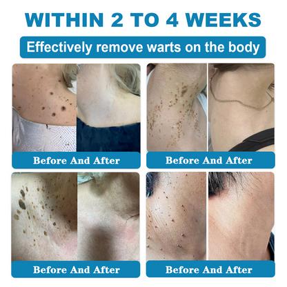 𝑶𝒏𝒍𝒚 4 Bottle! 𝑮𝒓𝒂𝒃 𝒂𝒏 𝒆𝒙𝒄𝒍𝒖𝒔𝒊𝒗𝒆 80% 𝒅𝒊𝒔𝒄𝒐𝒖𝒏𝒕 𝒏𝒐𝒘! 𝑲𝒆𝒆𝒑 𝒚𝒐𝒖𝒓 𝒔𝒌𝒊𝒏 𝒚𝒐𝒖𝒕𝒉𝒇𝒖𝒍 𝒂𝒏𝒅 𝒈𝒍𝒐𝒘𝒊𝒏𝒈 𝒊𝒏 𝒋𝒖𝒔𝒕 1 𝒕𝒐 4 𝒘𝒆𝒆𝒌𝒔. 𝑫𝒐𝒏’𝒕 𝒎𝒊𝒔𝒔 𝒚𝒐𝒖𝒓 𝒄𝒉𝒂𝒏𝒄𝒆—𝒕𝒉𝒊𝒔 𝒐𝒇𝒇𝒆𝒓 𝒘𝒐𝒏’𝒕 𝒄𝒐𝒎𝒆 𝒂𝒓𝒐𝒖𝒏𝒅 𝒂𝒈𝒂𝒊𝒏 𝒖𝒏𝒕𝒊𝒍 𝒏𝒆𝒙𝒕 𝒚𝒆𝒂𝒓. 180-𝒅𝒂𝒚 𝒎𝒐𝒏𝒆𝒚 𝒃𝒂𝒄𝒌 𝒈𝒖𝒂𝒓𝒂𝒏𝒕𝒆𝒆! HISKIN®