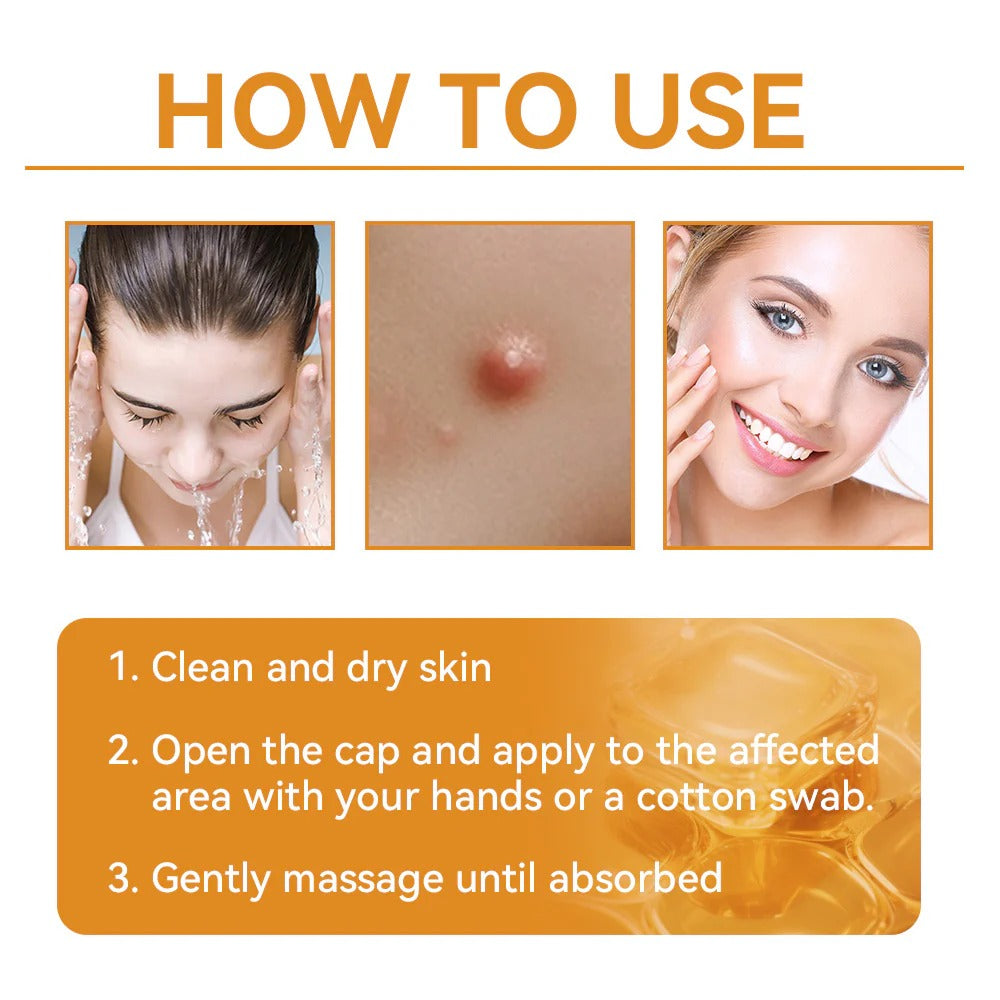 One last chance! Grab this lucky find at 90% OFF to erase warts permanently!🔥 180-day money back guarantee! Act fast! HISKIN®